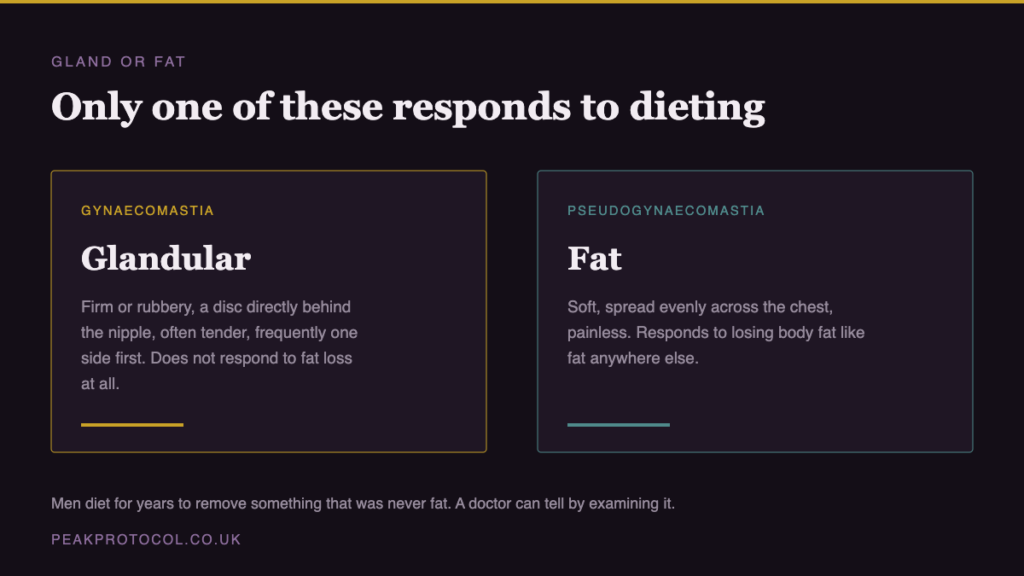 Comparison showing glandular gynaecomastia is firm and sits behind the nipple and does not respond to dieting while pseudogynaecomastia is soft chest fat that does