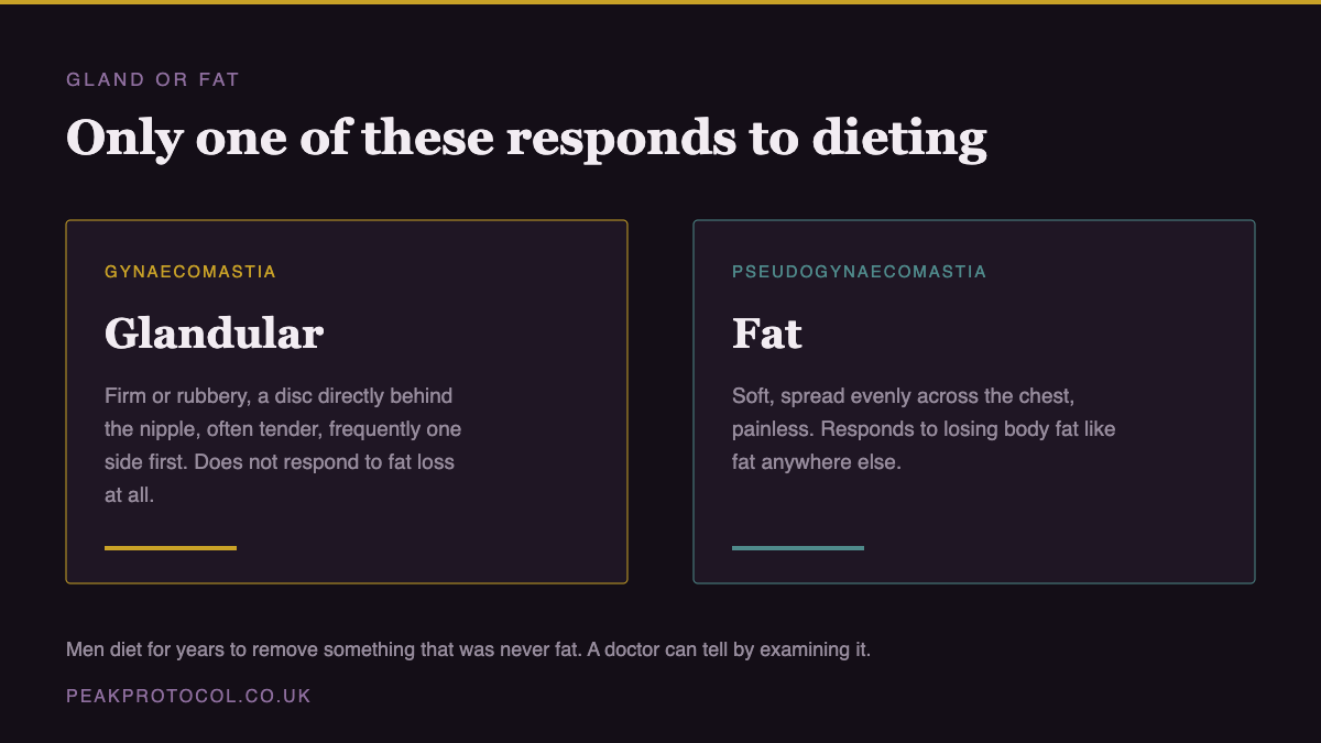 Comparison showing glandular gynaecomastia is firm and sits behind the nipple and does not respond to dieting while pseudogynaecomastia is soft chest fat that does